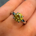 Yellow gemstone ring on a finger